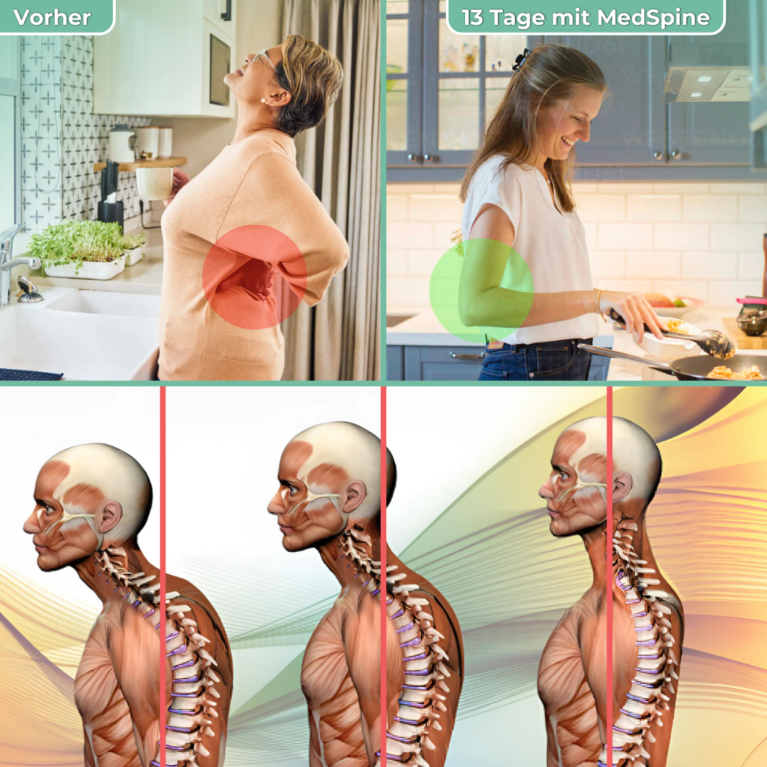 MedSpine™ - 3 in 1 Therapiekissen